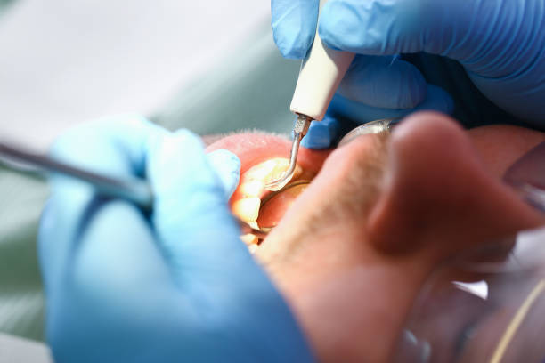 Emergency Dentist for Kids in KS