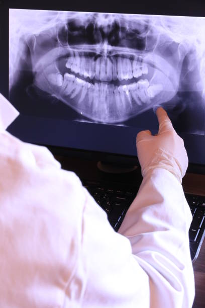 Best Root Canal Emergency Dentist  in Cimarron, KS