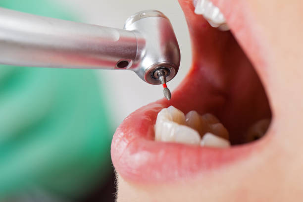 Best Urgent Tooth Repair  in Cimarron, KS